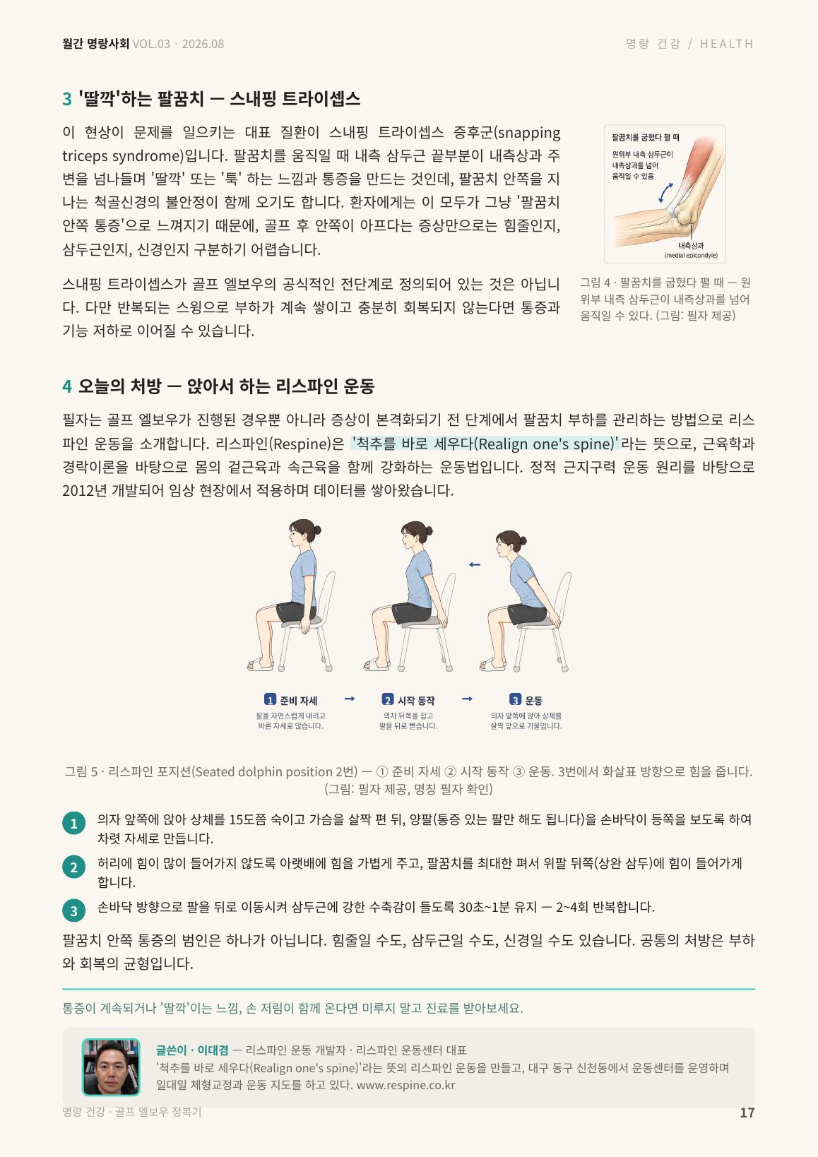 17면